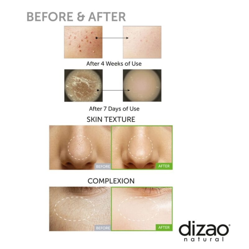 Dizao Mikroadatinis serumas su spikulėmis ir egzosomomis BOOSTER SHOT 100 - 160.000 adatėlių