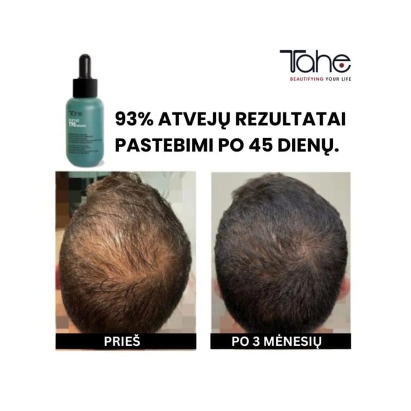Plaukų slinkimą mažinantis ir augimą skatinantis koncentratas Peptide T98 TAHE, 50 ml